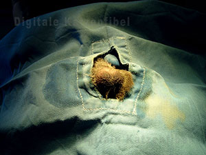 Bild 2. Zustand direkt vor OP, Steriles OP-Tuch, Op-Feld desinfiziert