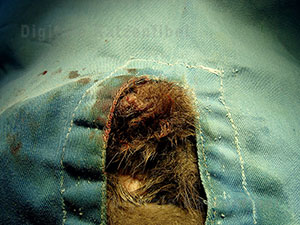 Bild 7. Zustand nach OP