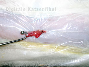 Bild 2. Vorverlagerung des Eierstocks