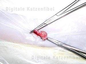 Bild 3. Abklemmen und Abbinden der Blutgefäße