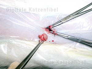 Bild 4. Entfernung des Eierstocks