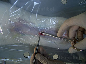 Bild 5. Verschließen der Wunde