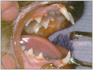 Entzündetes Zahnfleisch (Gingivitis)